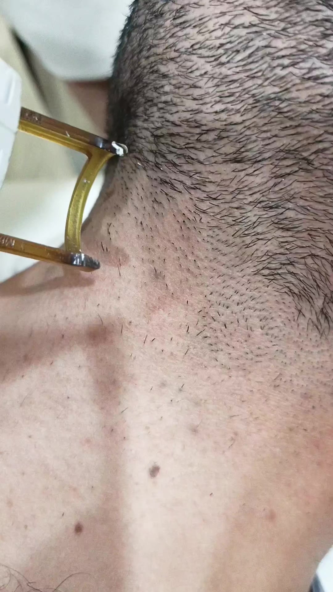 @Laser Grafix clinic