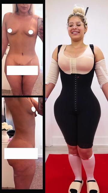 @Vixen Plastic Surgery