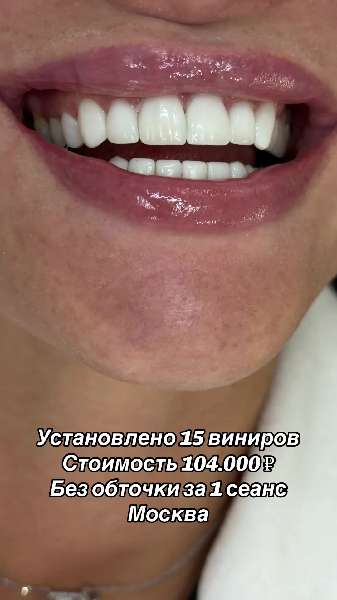 @Royal_smile_moscow
