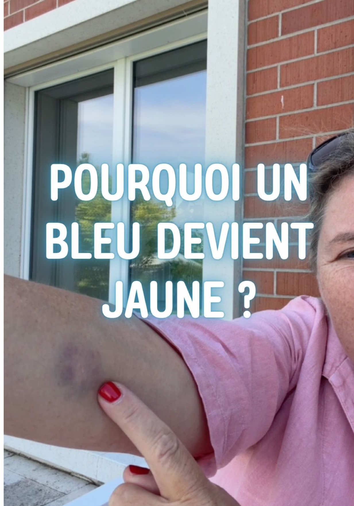 @Caroline Fabien, PhD
