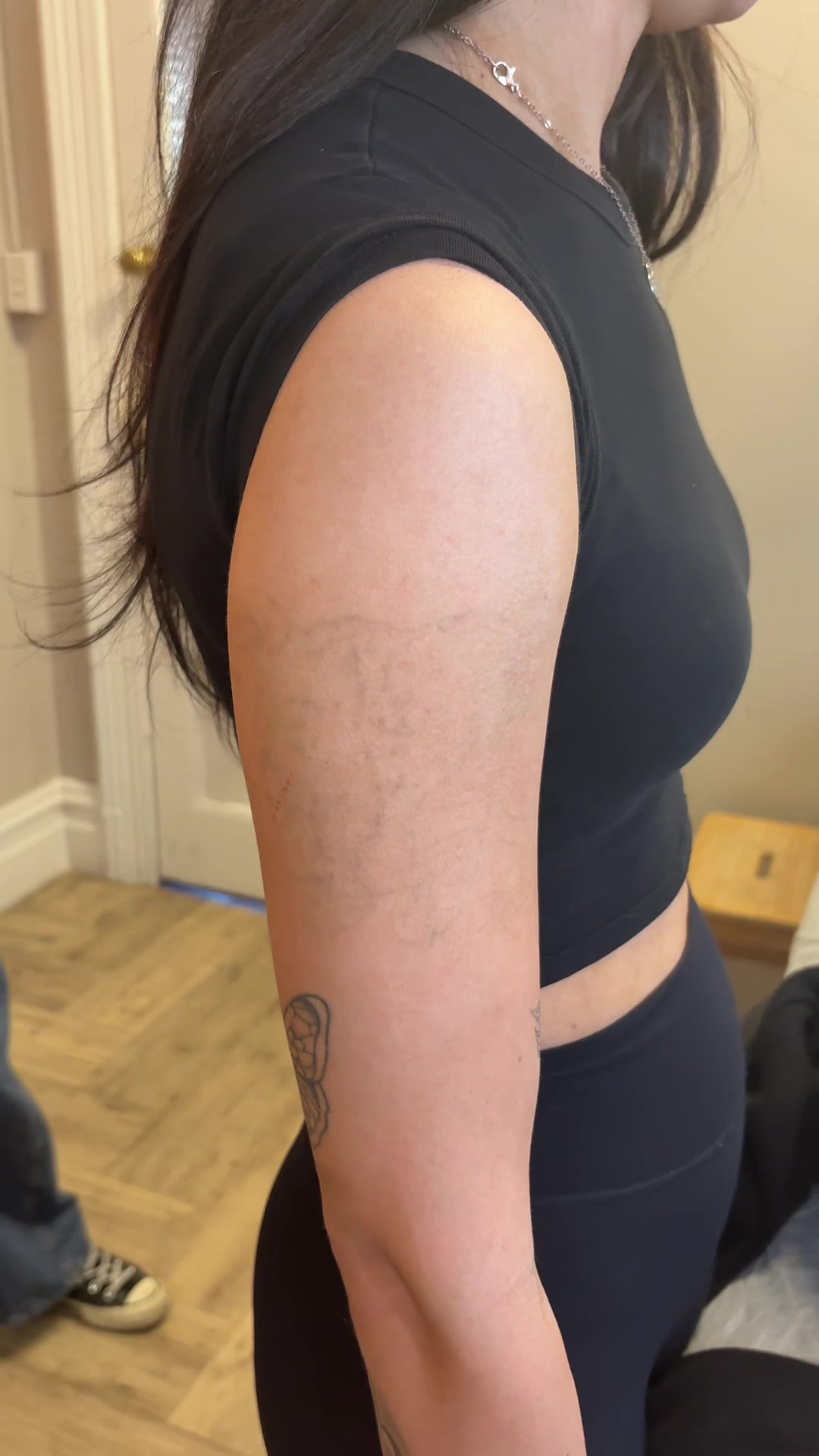 @Swift_tattoo_removal