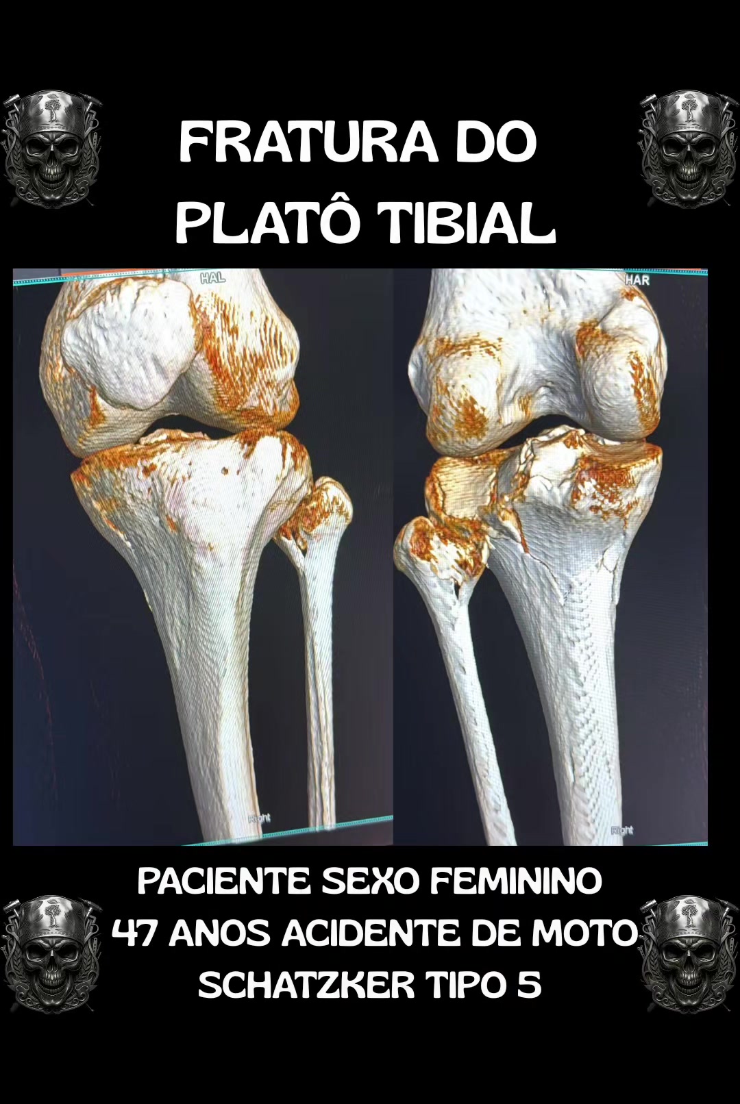 @Traumatologia Maluca