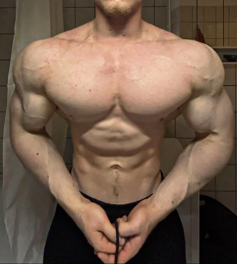@henningym