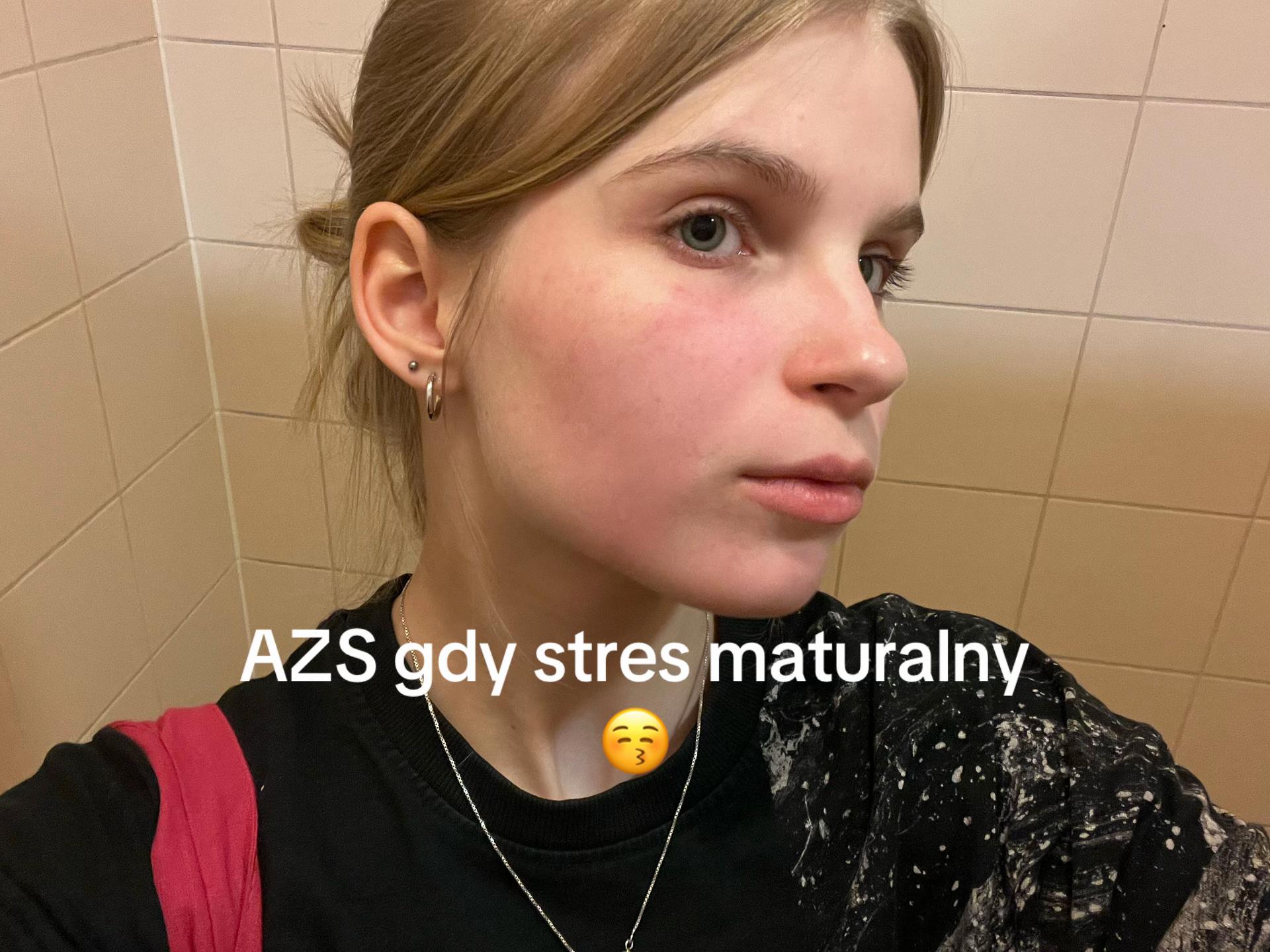 @Aiko