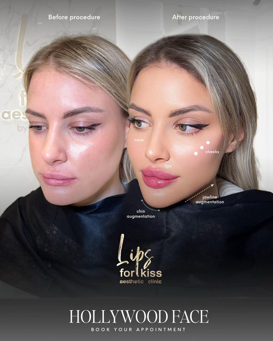 @Lips_for_kiss