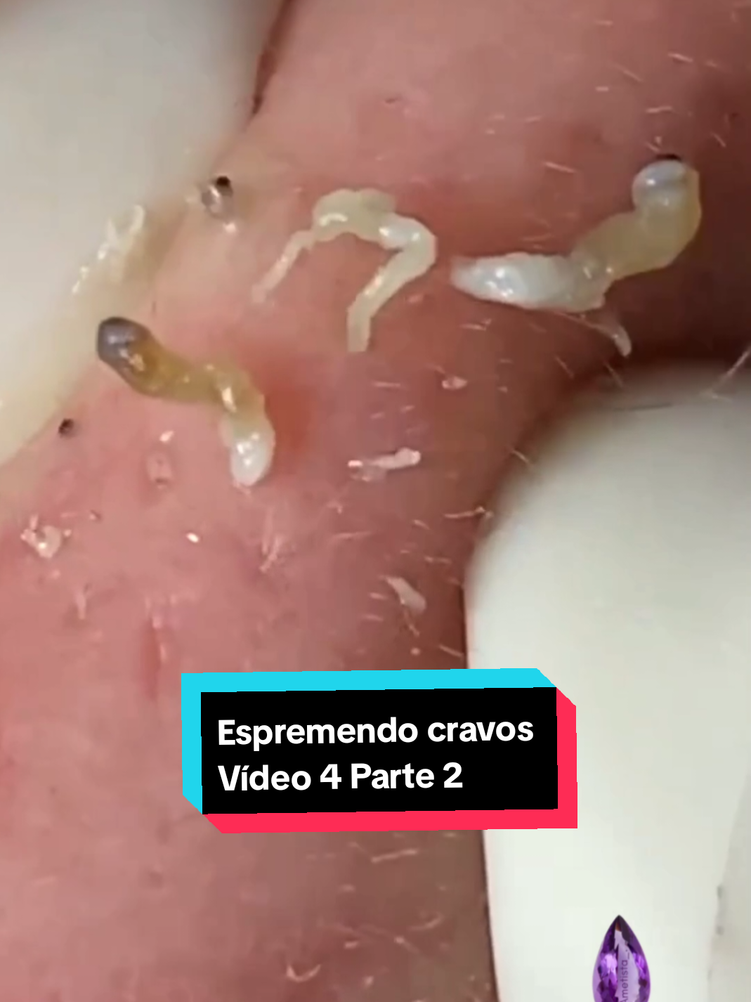 @ametista_.