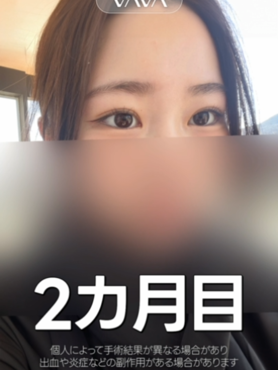 @VAVA美容整形外科