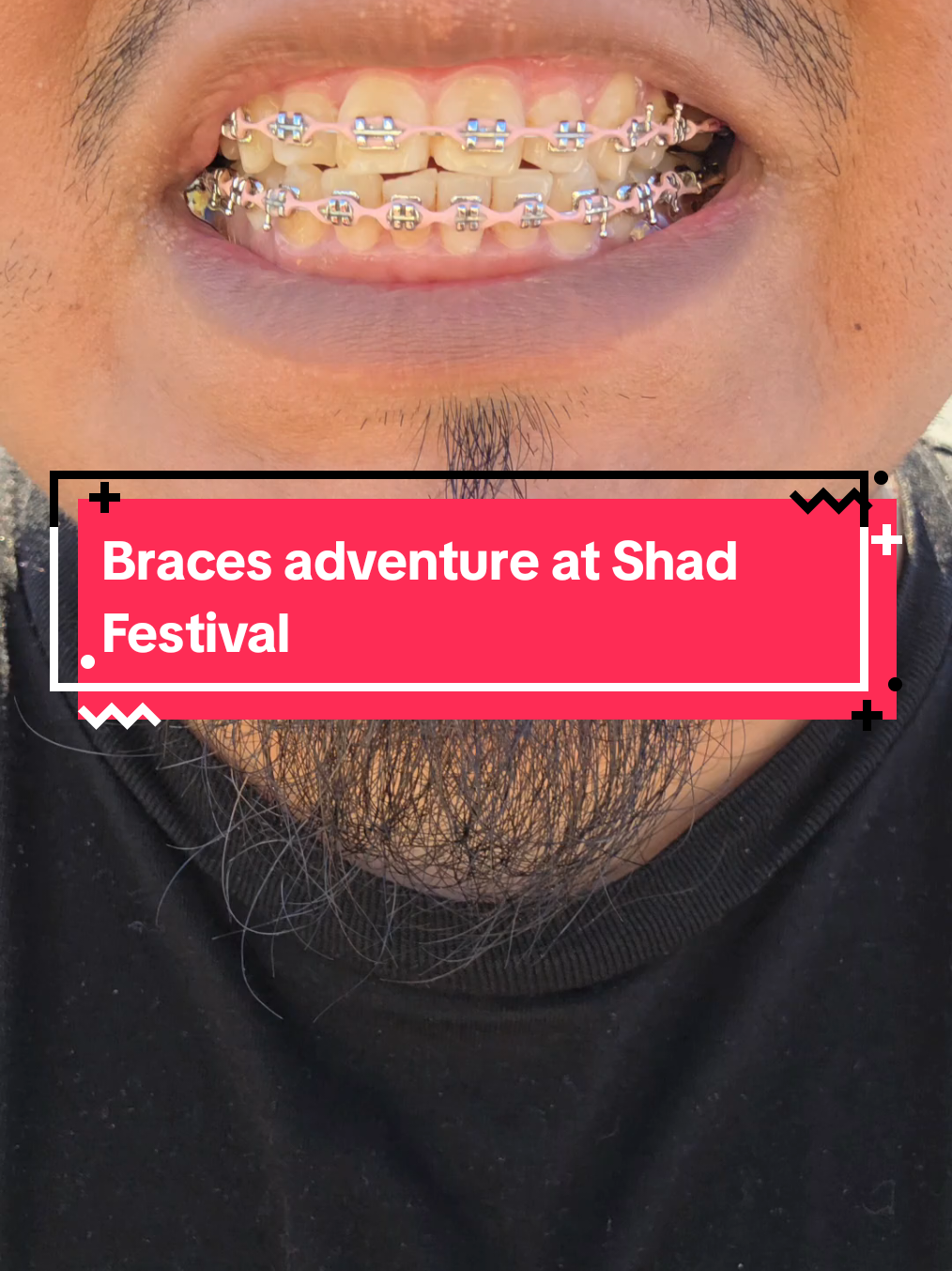 @str8braces