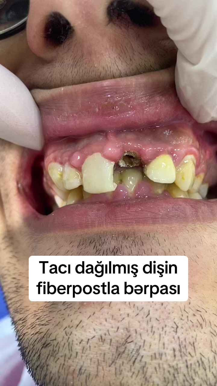 @dr_həmzət__