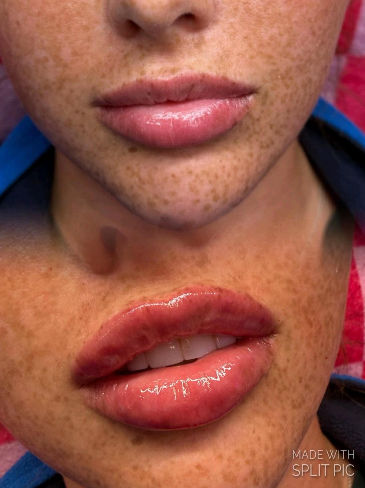 @Sculpted&CoByMelissa💉
