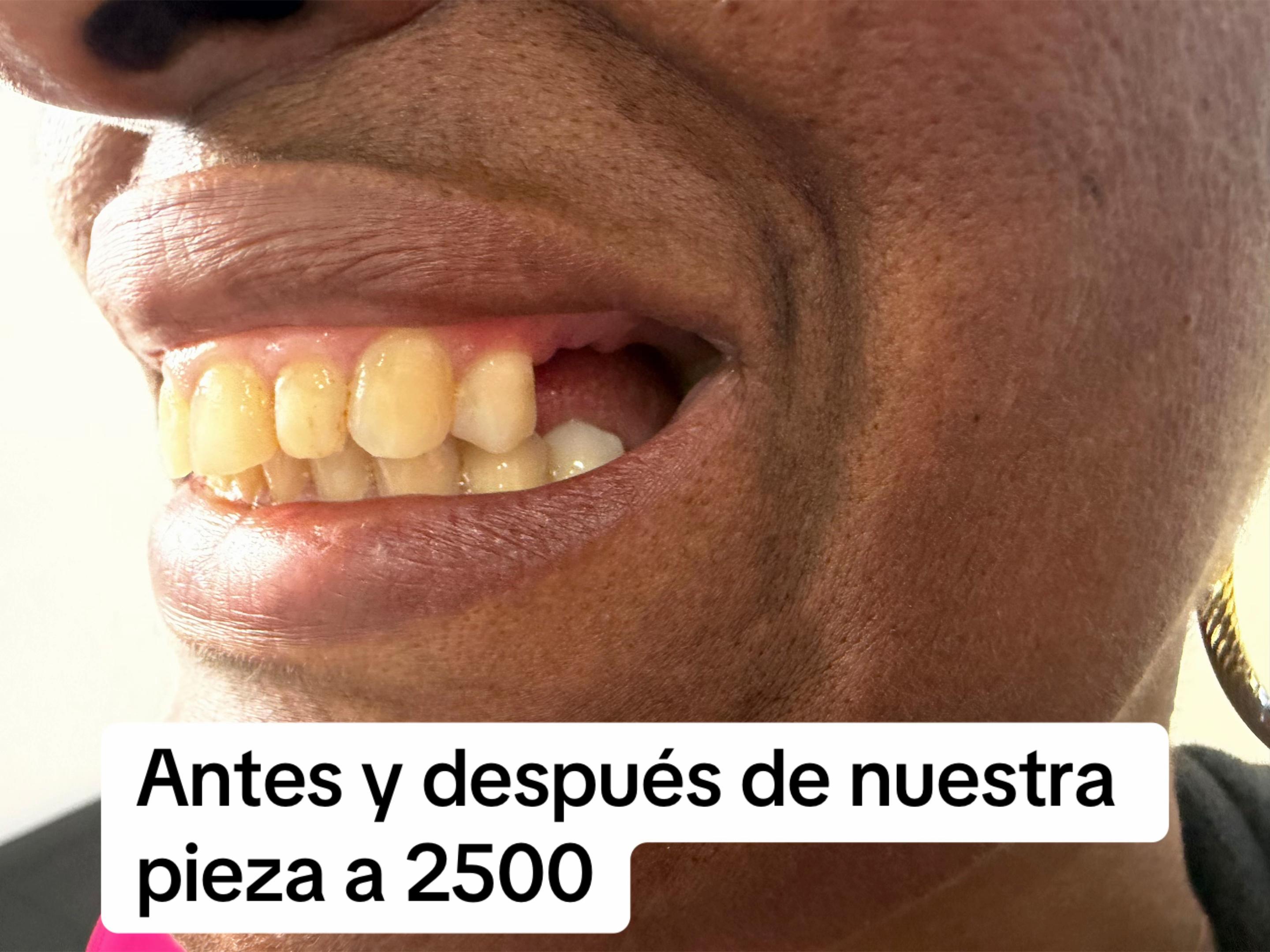 @InesDientes1