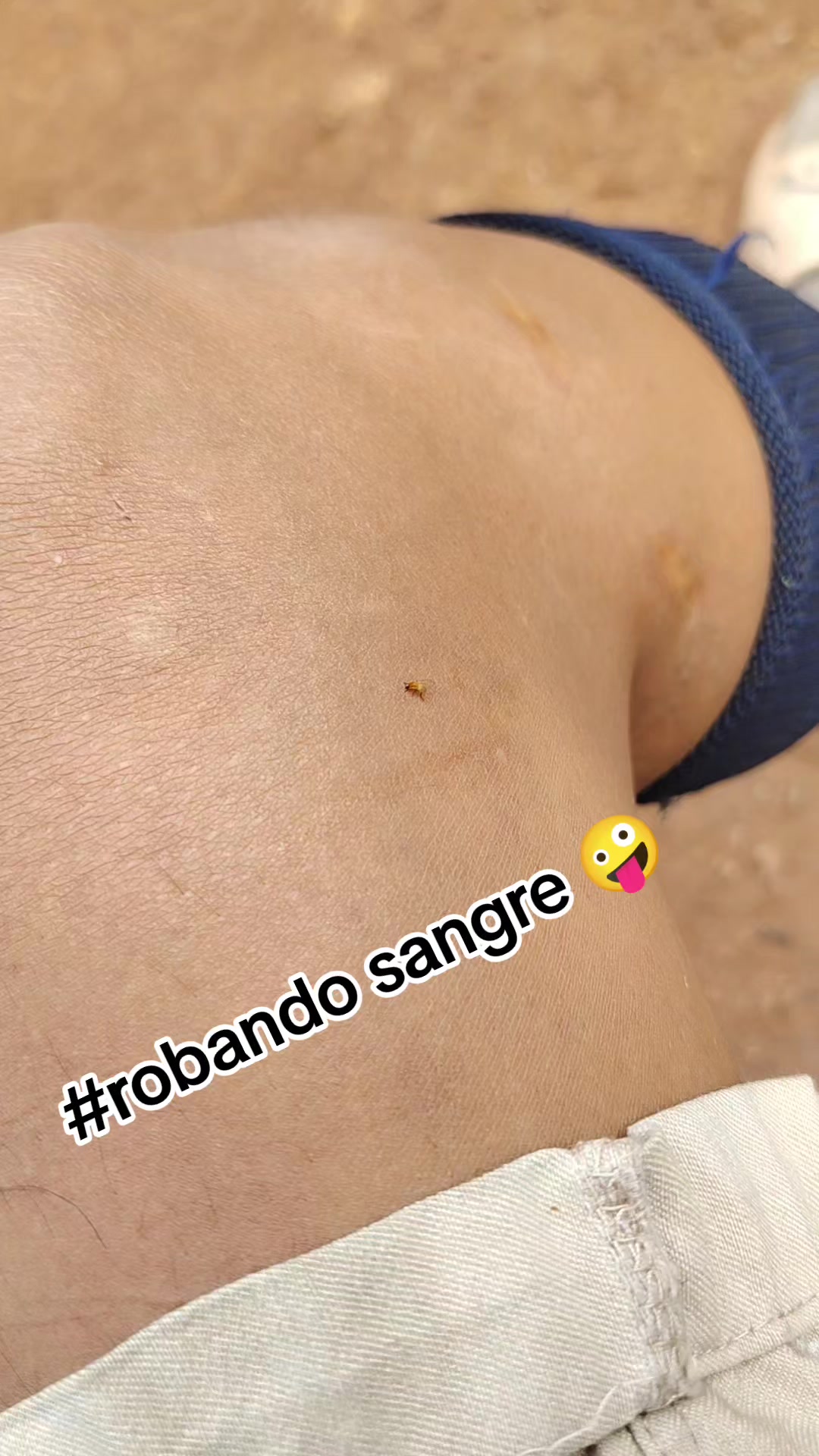 @Angelo Azakura Florez