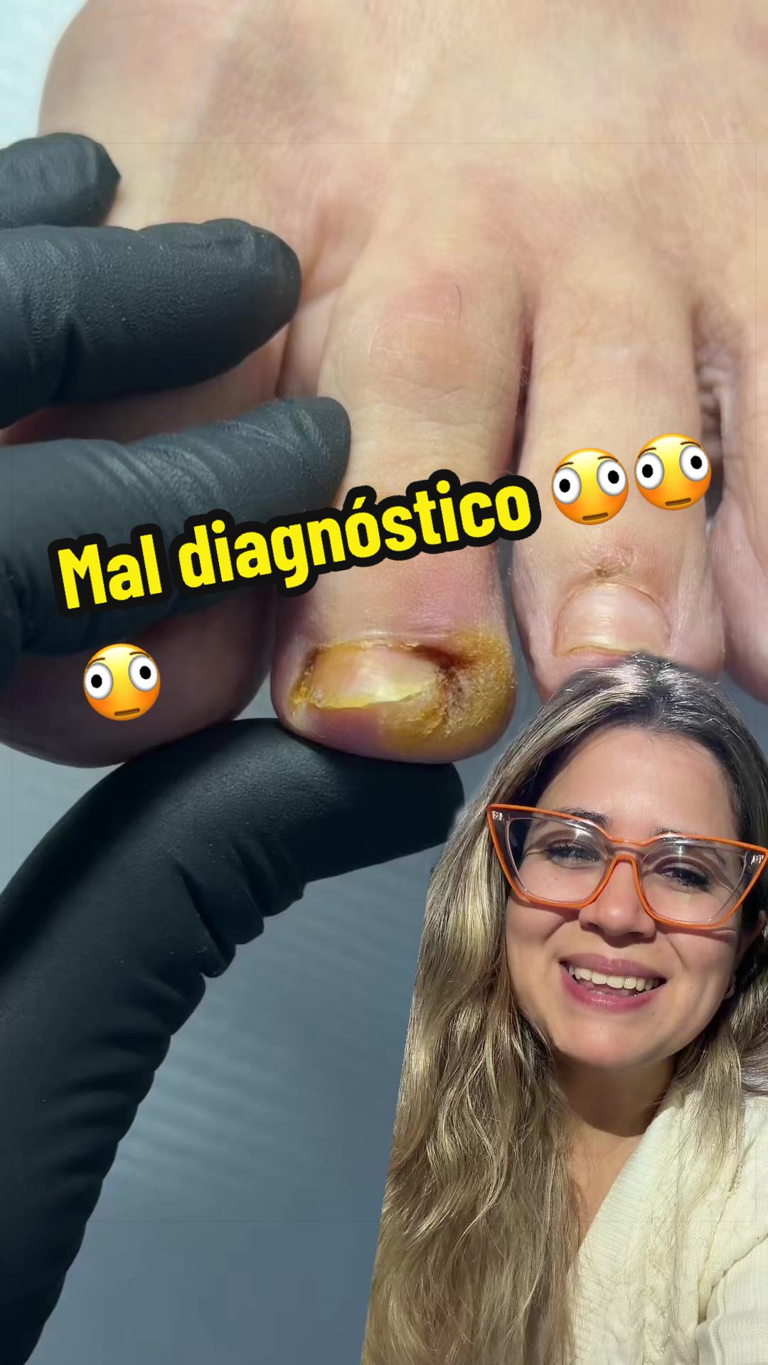 @podología calzada