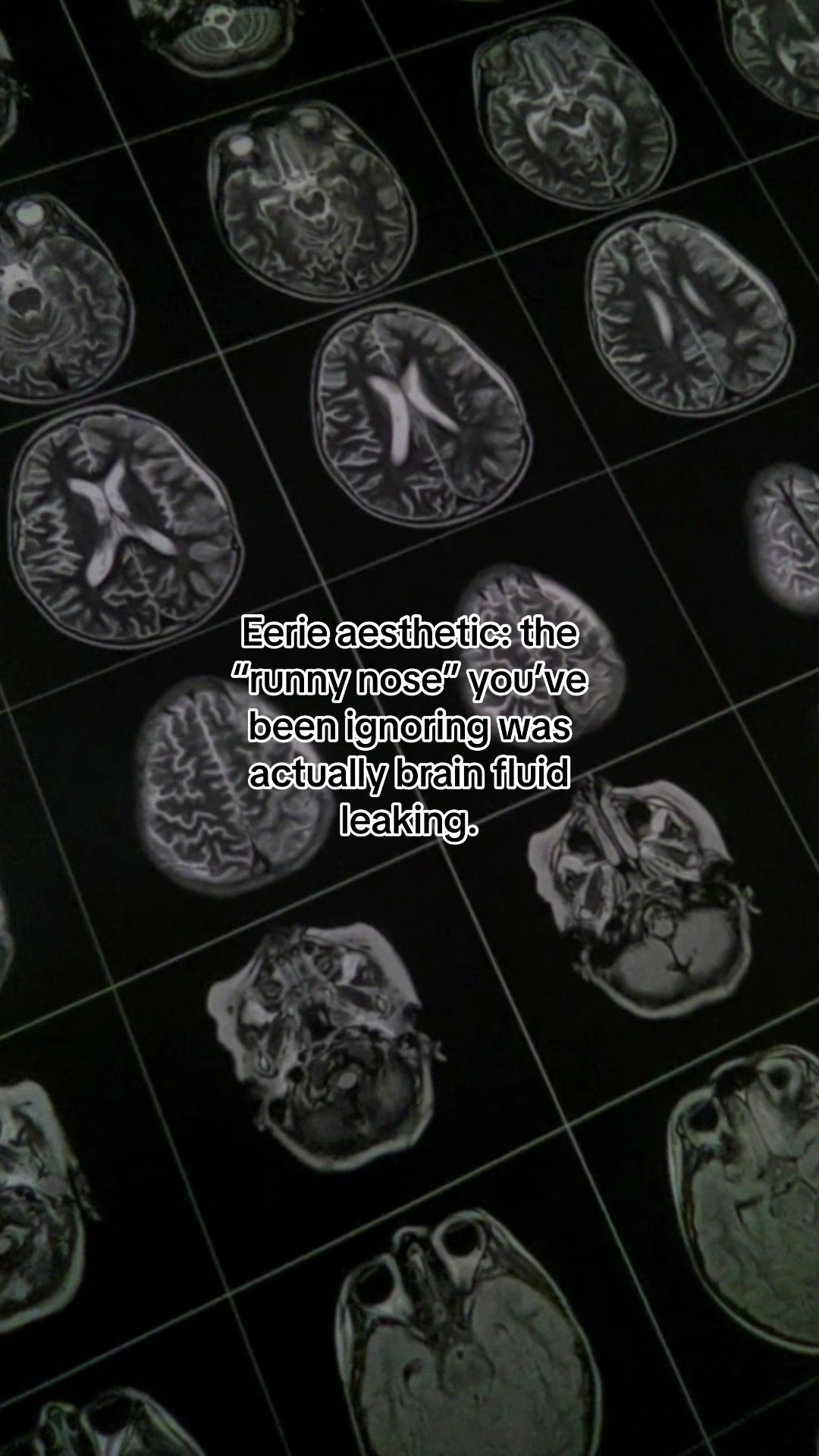 @Brainstormed