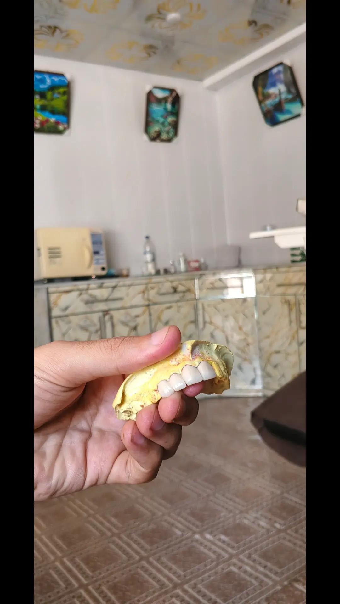 @Dr_sheraz_official 🦷