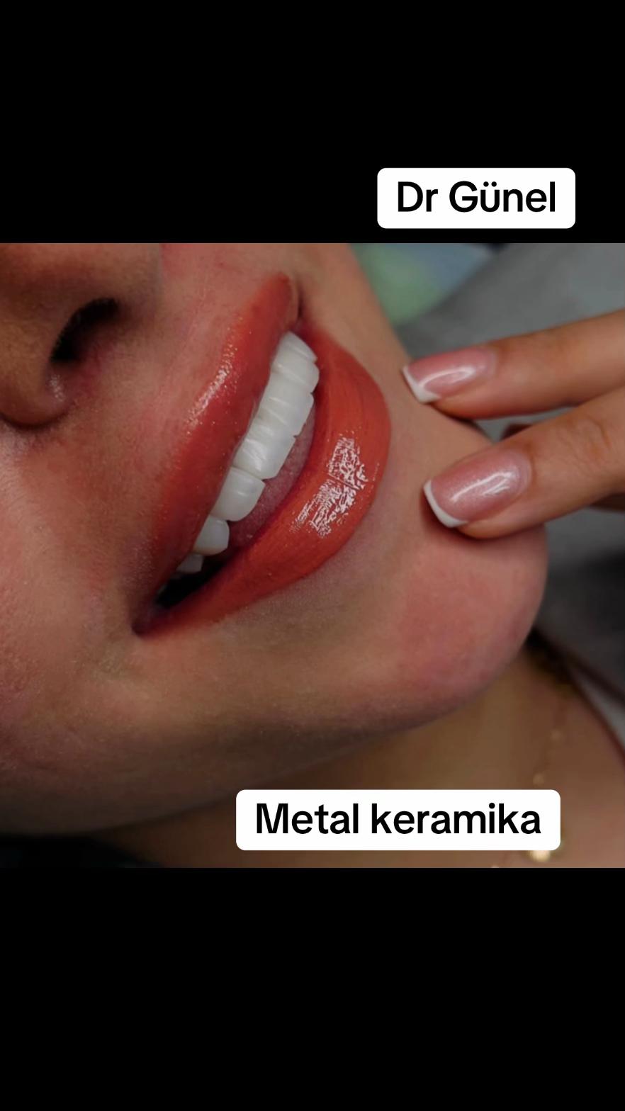 @Dentist_G&uuml;nel