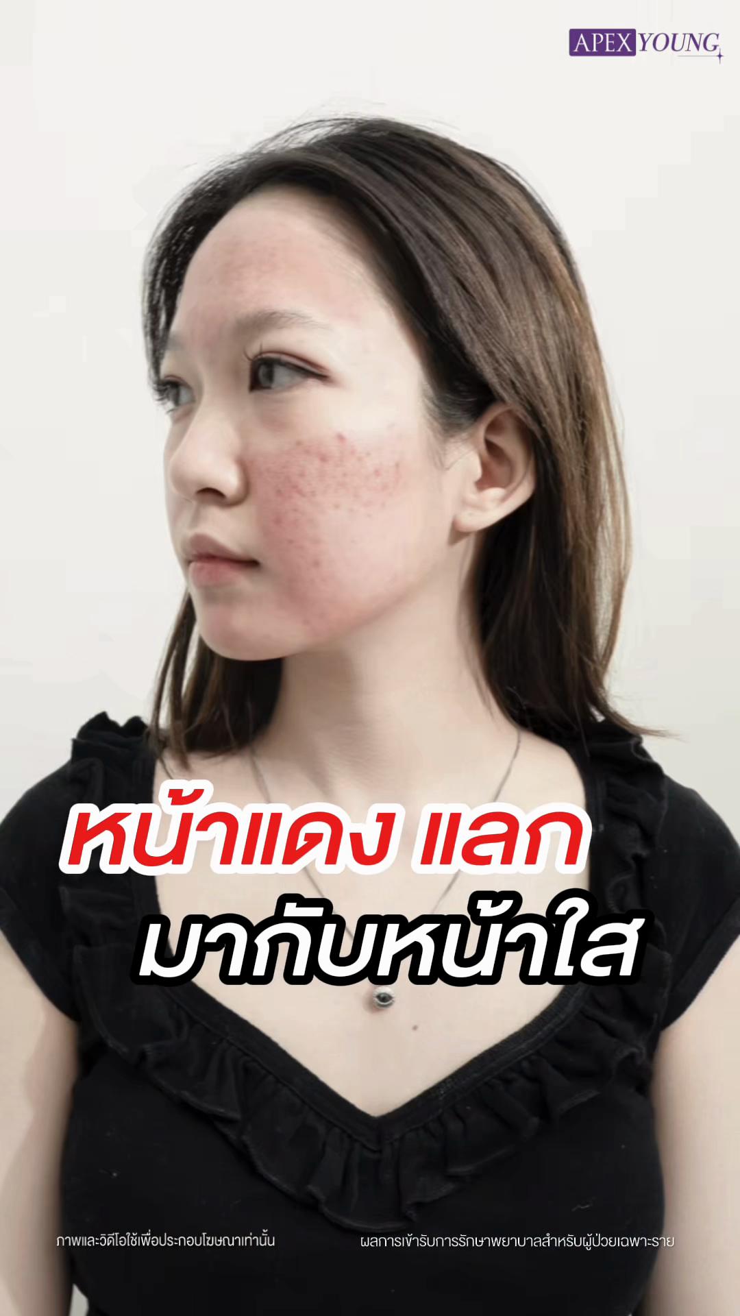 @APEXYOUNGCLINIC