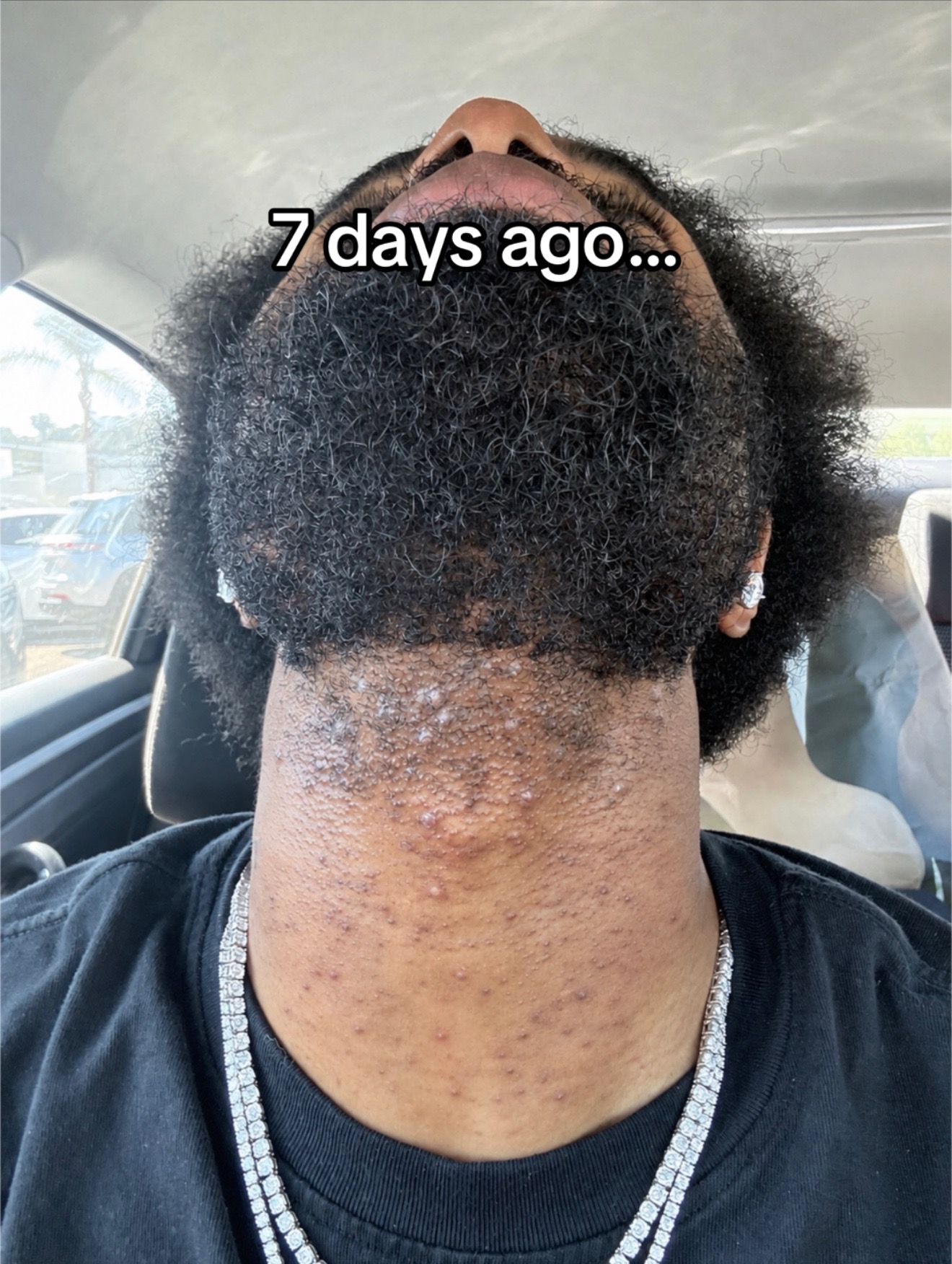 @Imtredarius