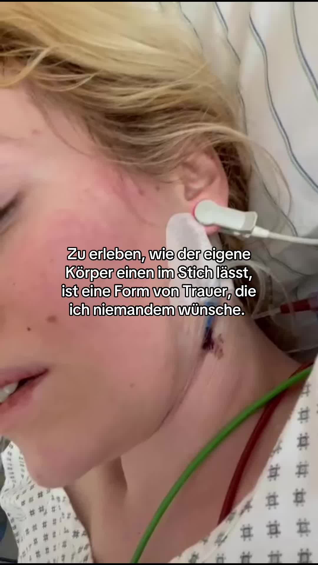@cagivaa_t1d