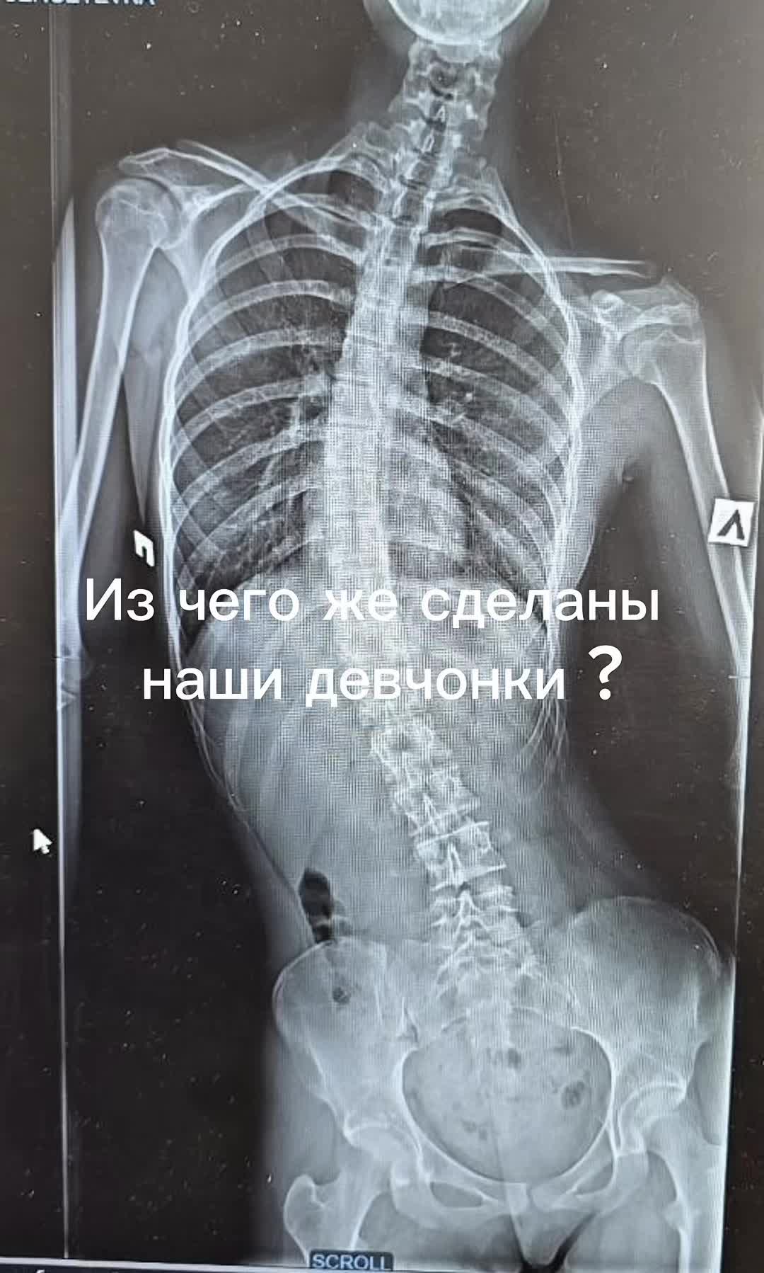 @Титановая леди