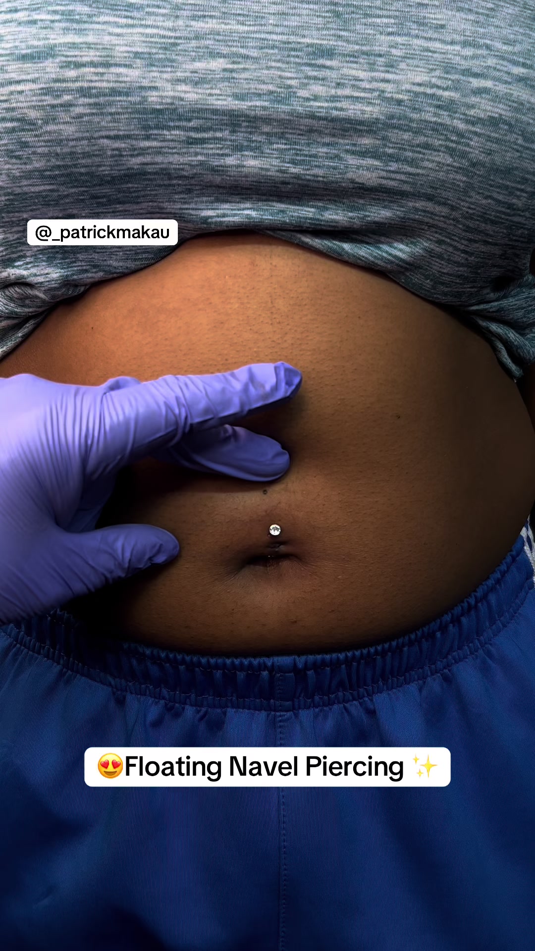 @Patrick Makau