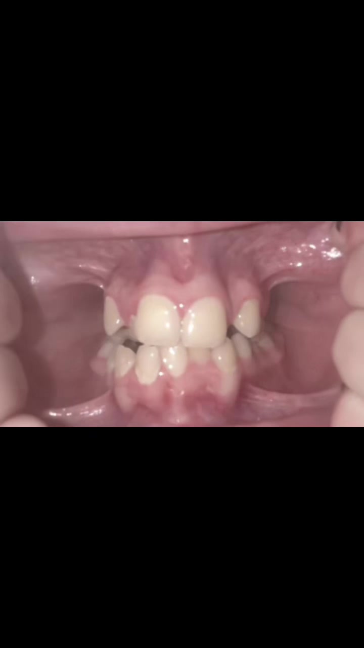 @𝐻𝒶𝓊𝓃𝓉𝑒𝒹