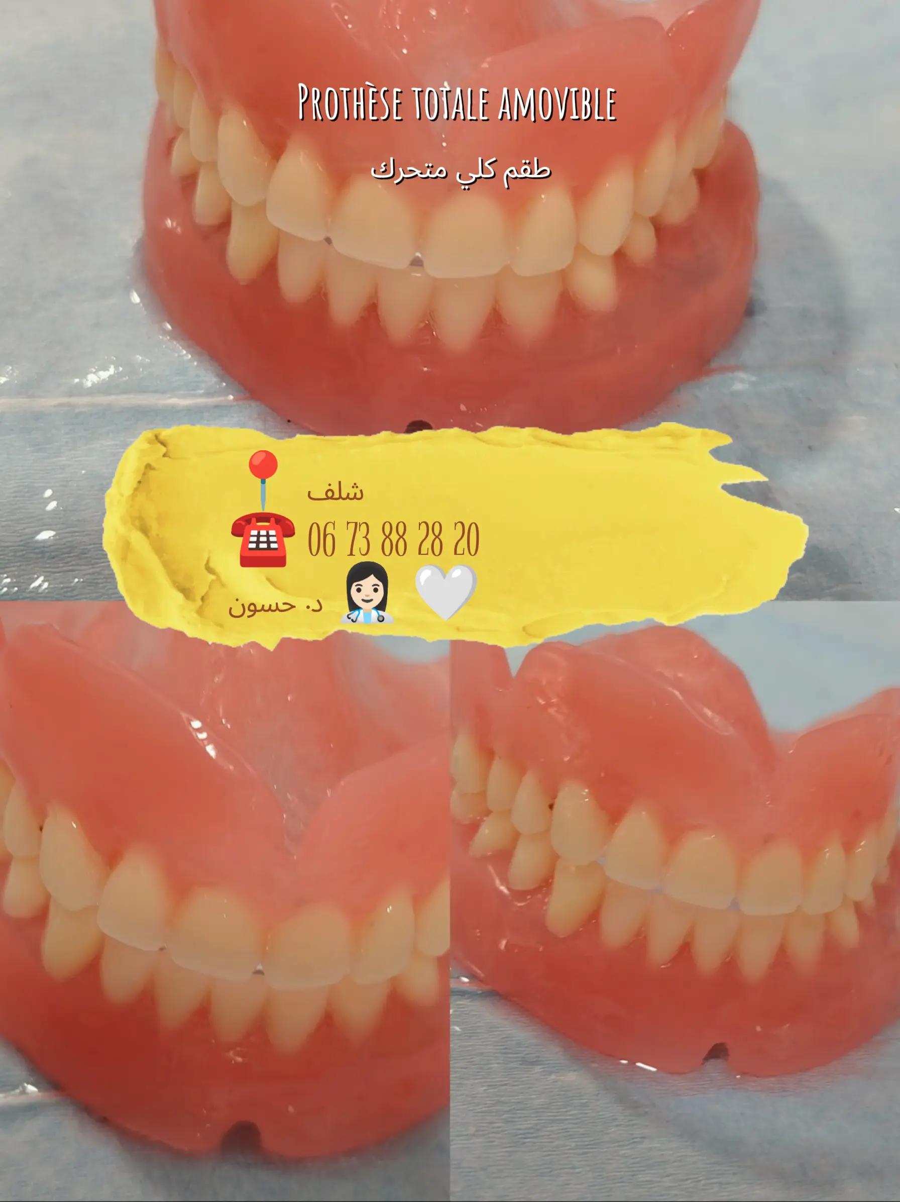 @Dr HASSOUN02 طبيبة الاسنان شلف