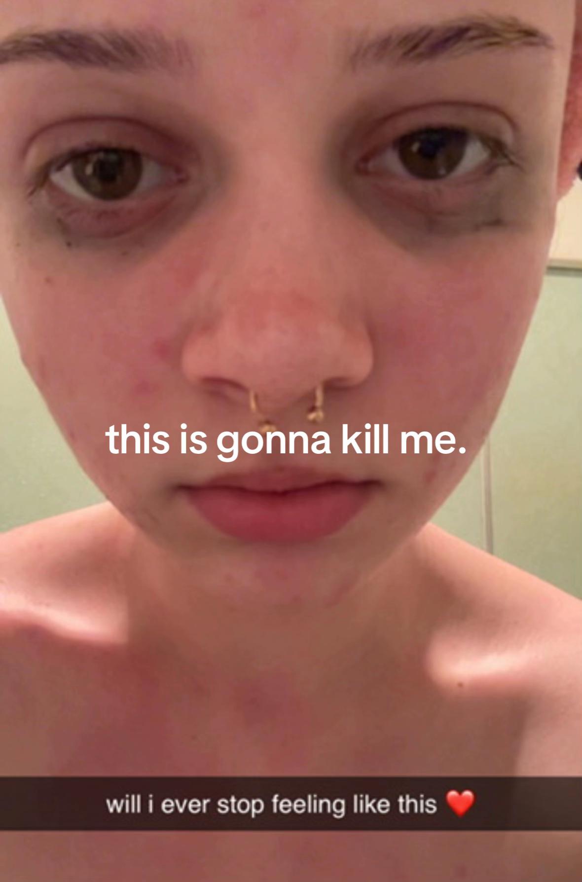 @nuggyluver