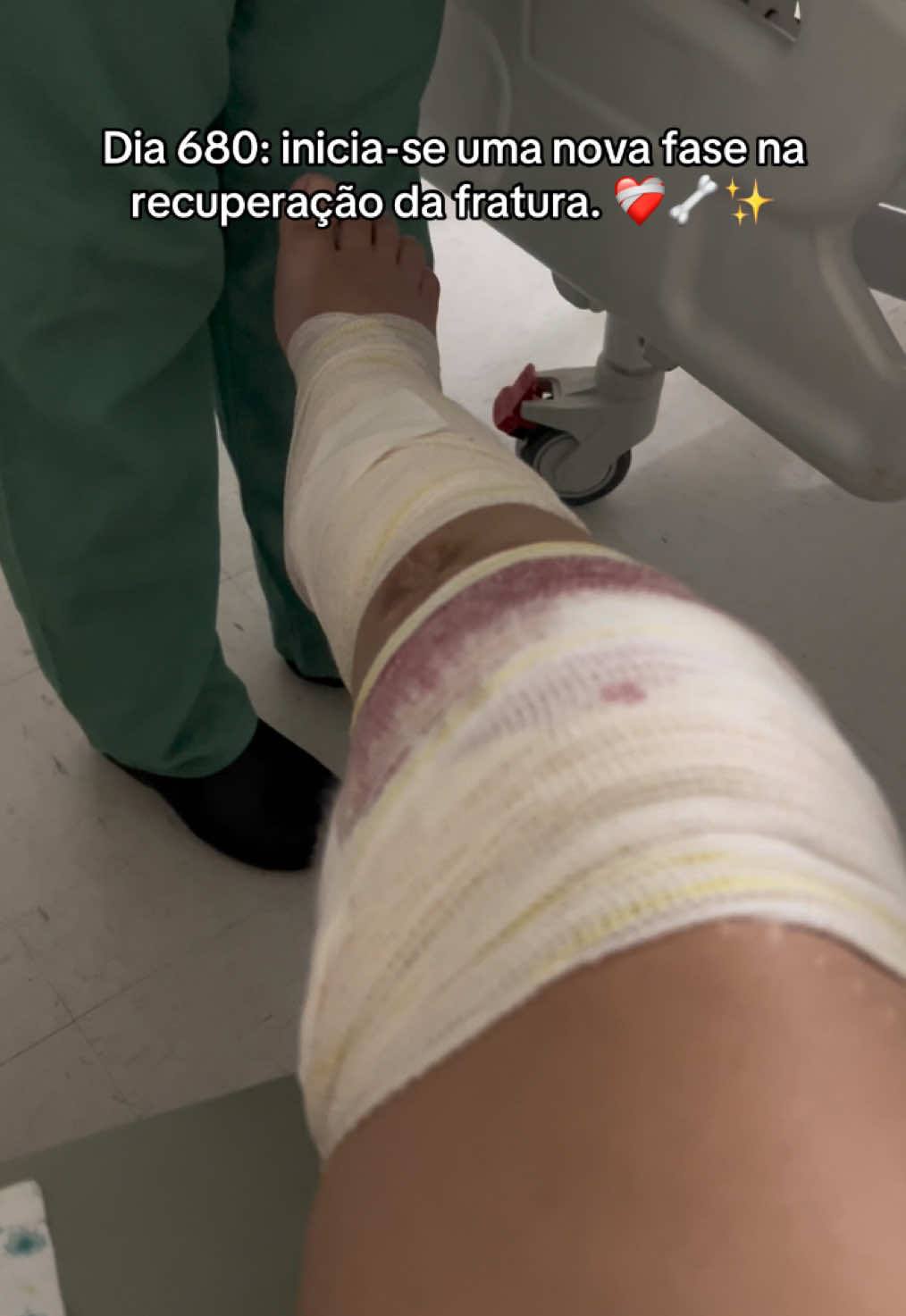 @Ana