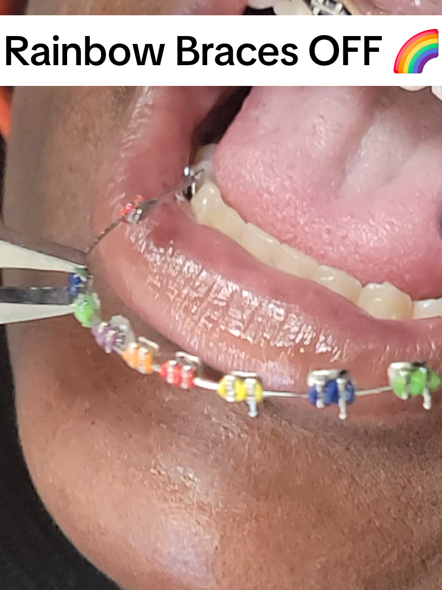 @SmileEnvyDental