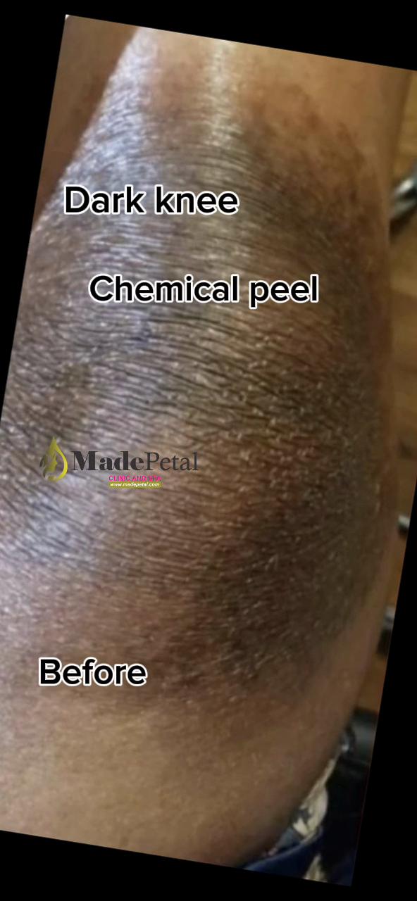 @Clinic and spa in magboro