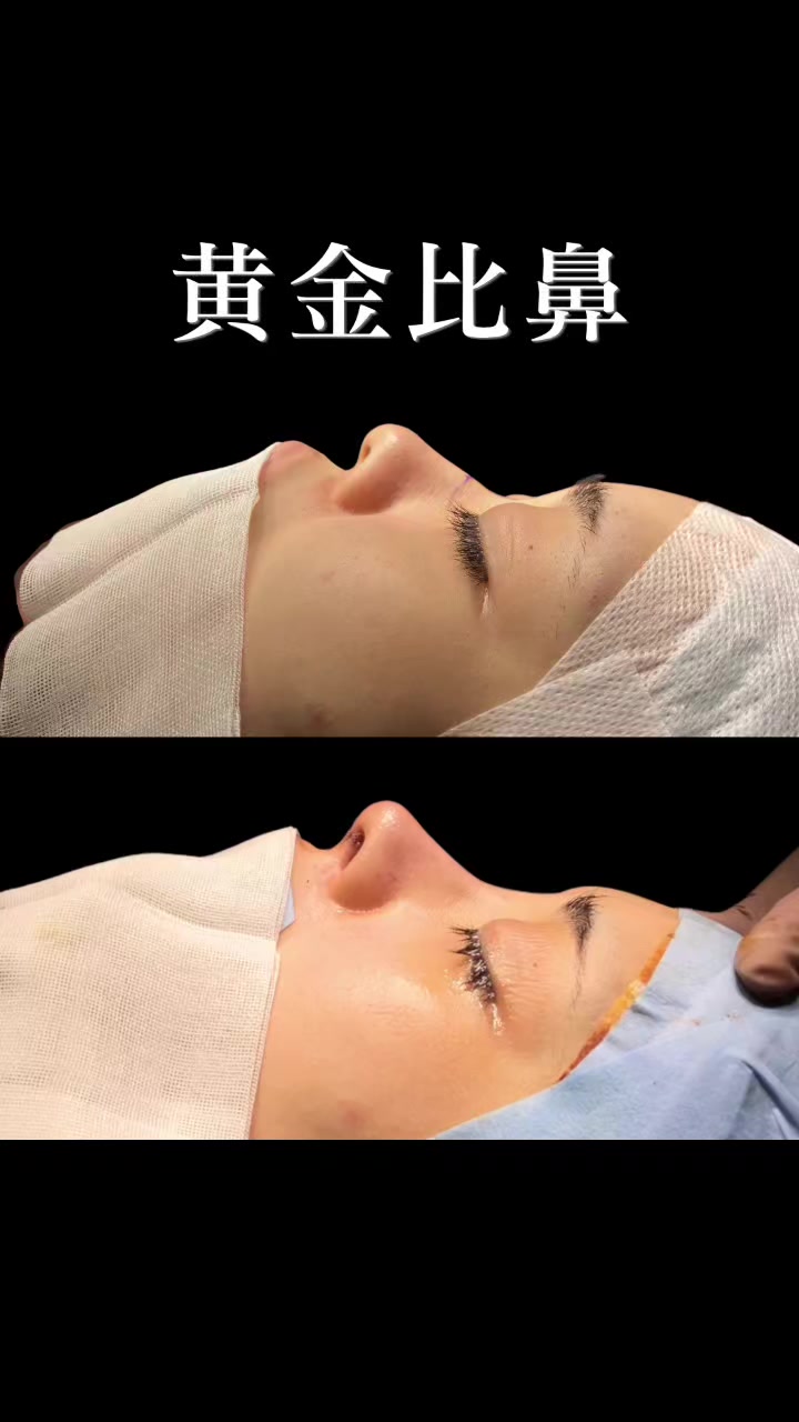 @ソ院長(バウム美容外科/トータル整形)