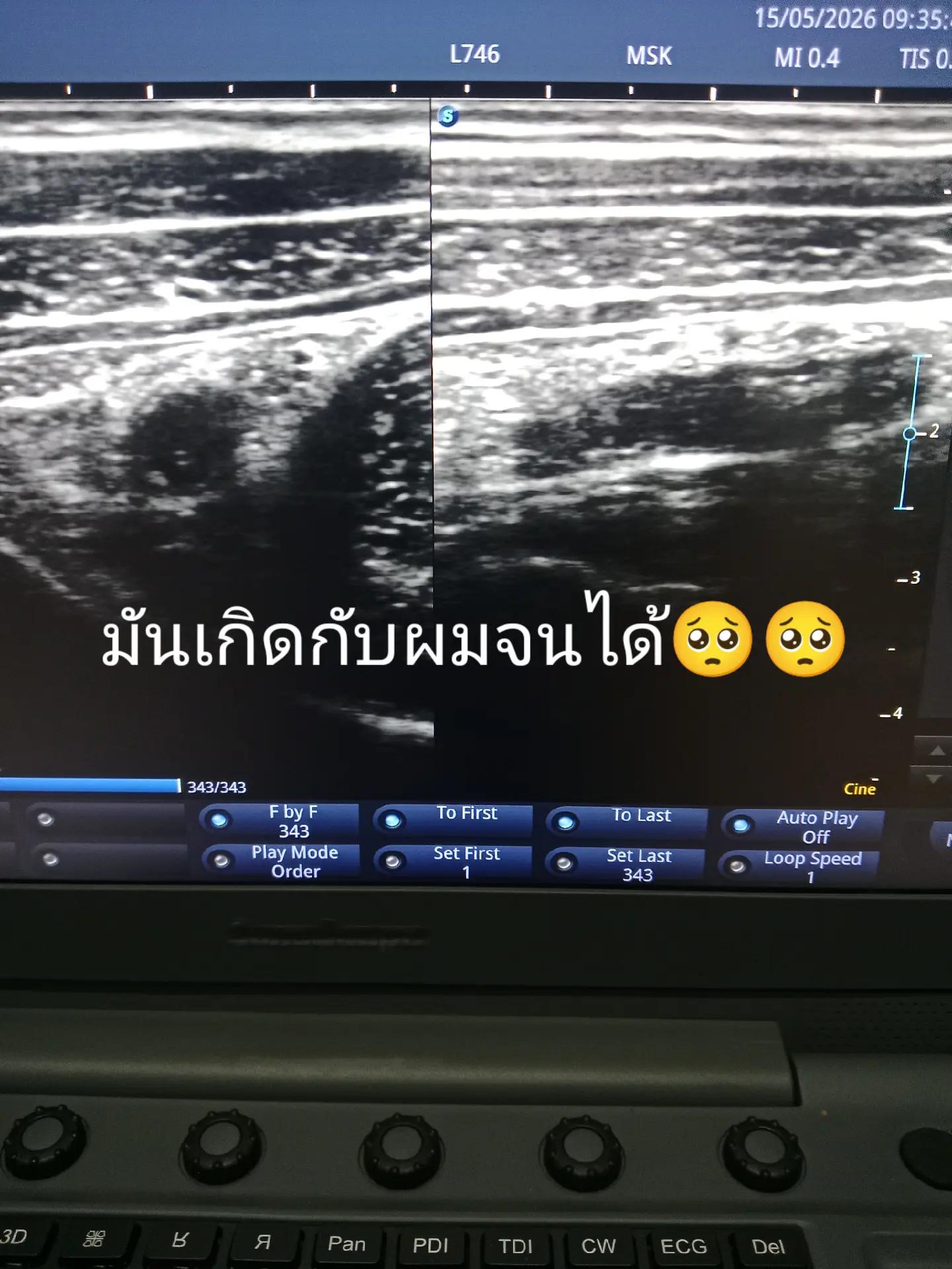 @พี่ต้น