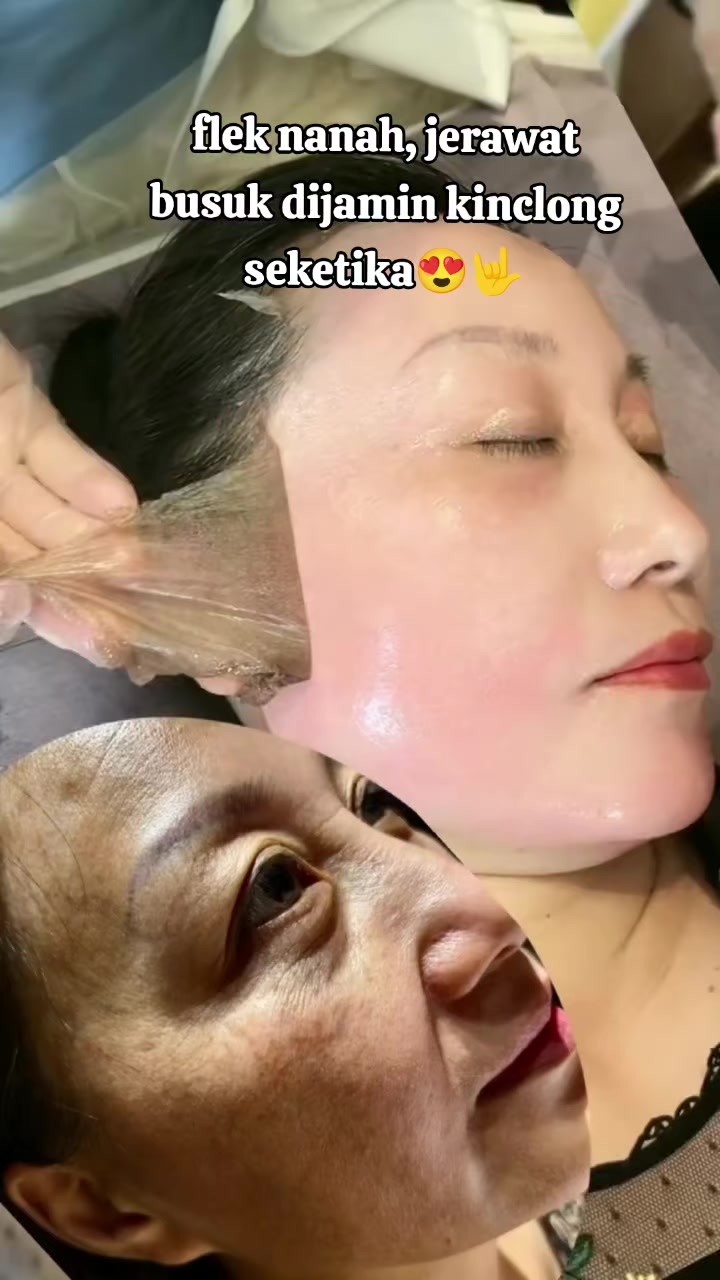 @Pemutih badan ampuh