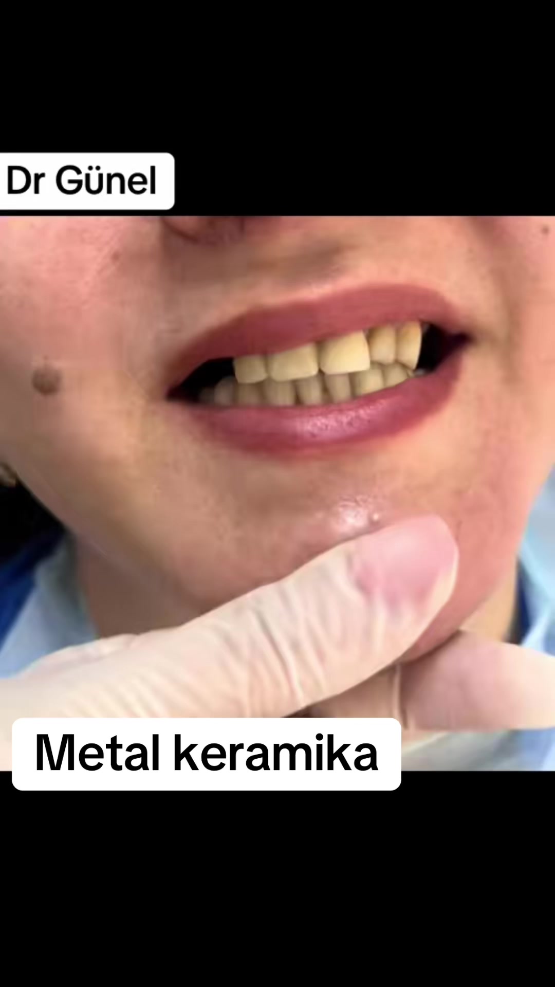 @Dentist_G&uuml;nel
