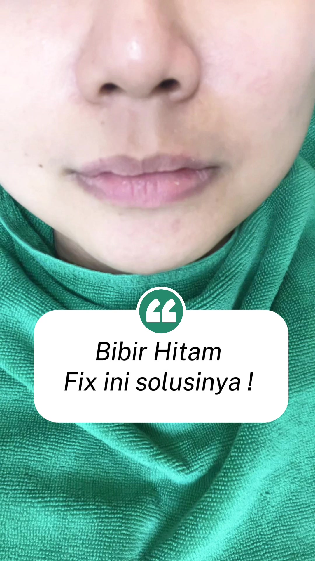 @Nana