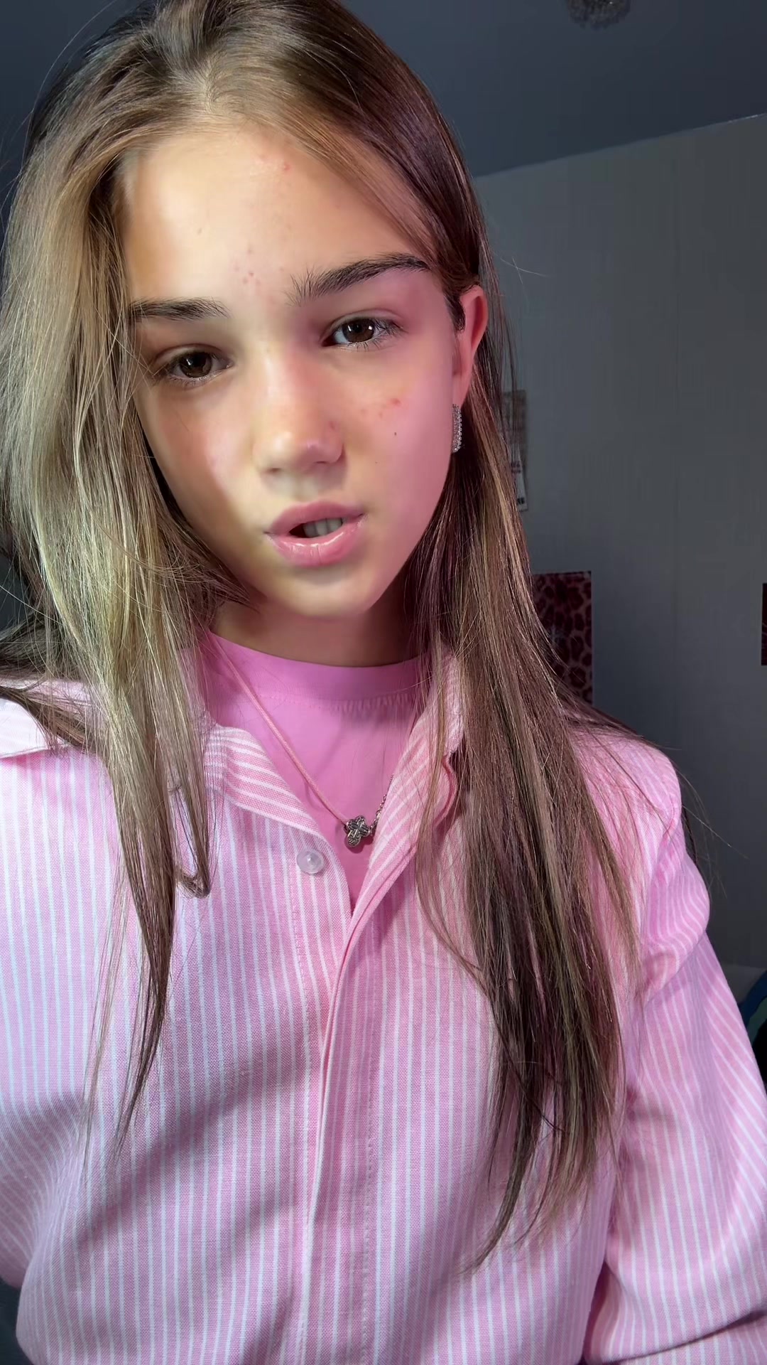 @Abazzz🎰💋🩵