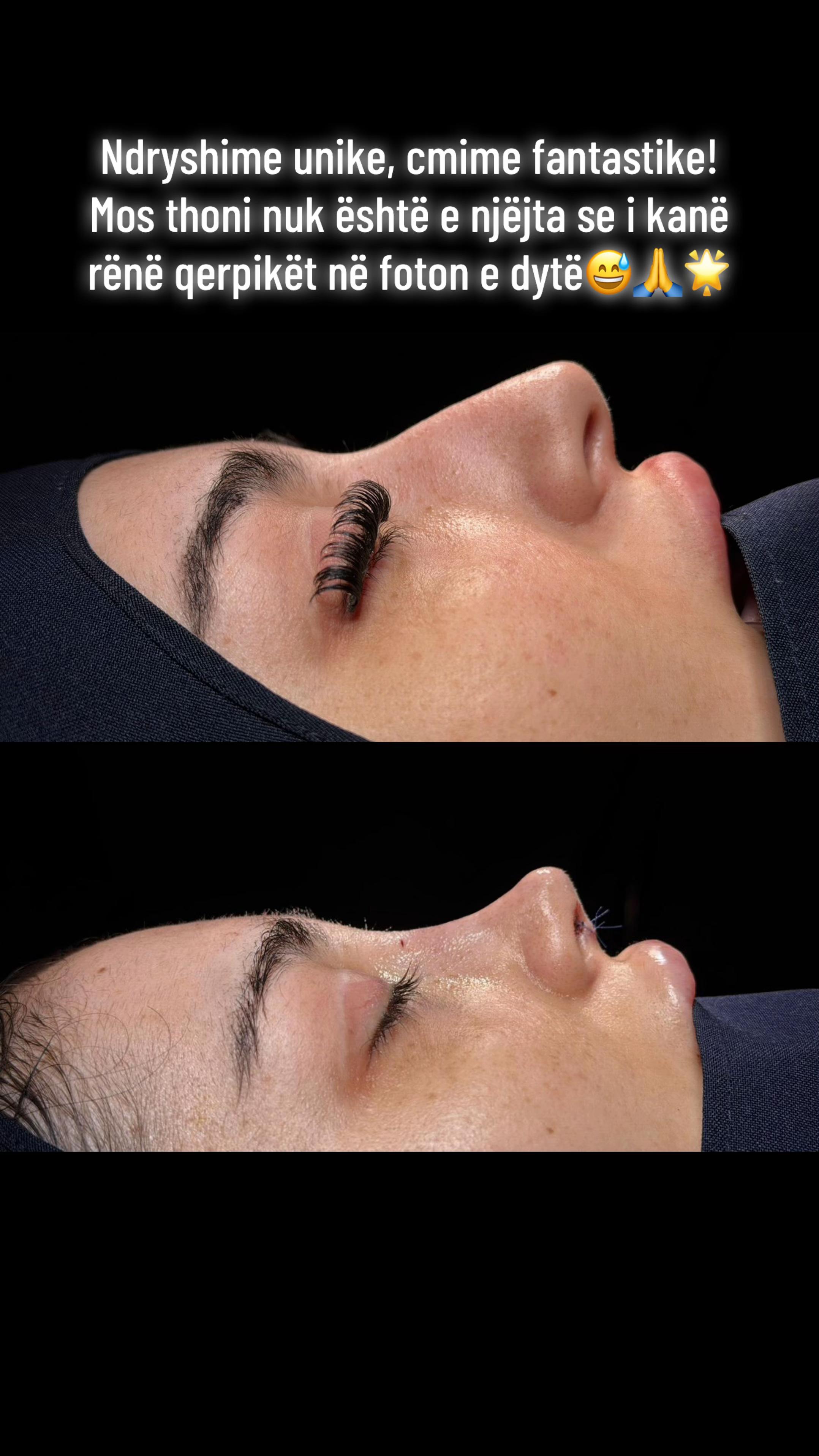 @rinoplasticatirana