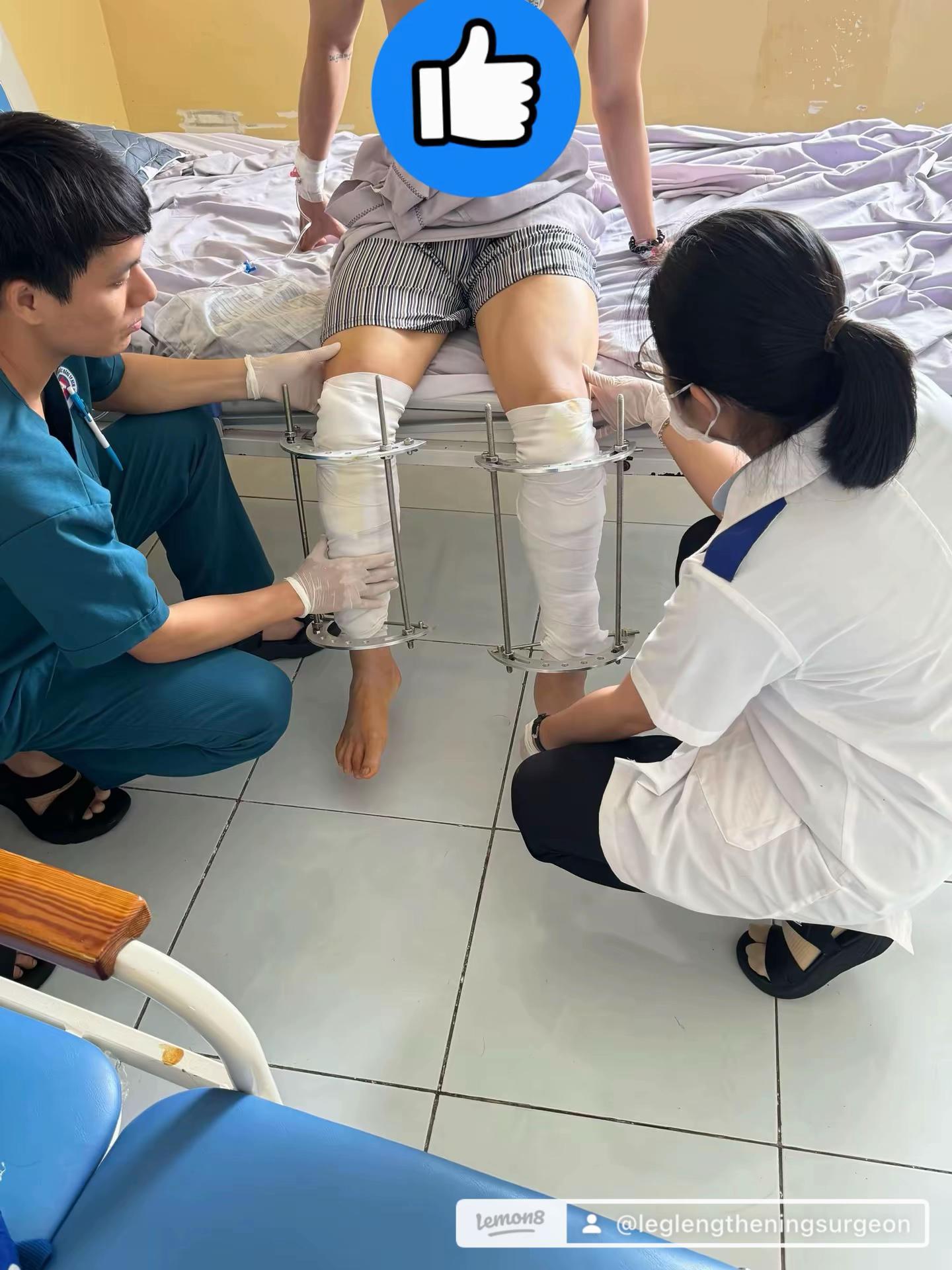 @K&eacute;o d&agrave;i ch&acirc;n TPHCM