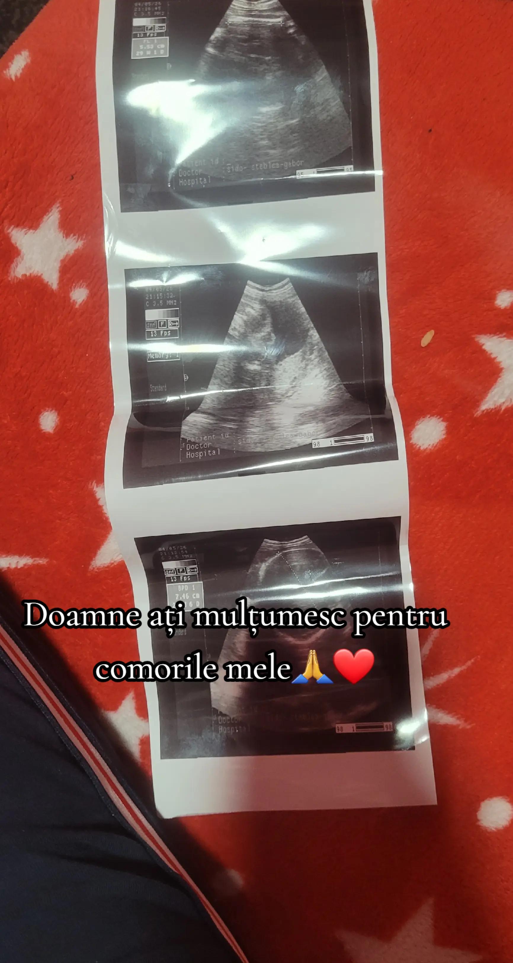 @♡Roxana❤️Yani♡