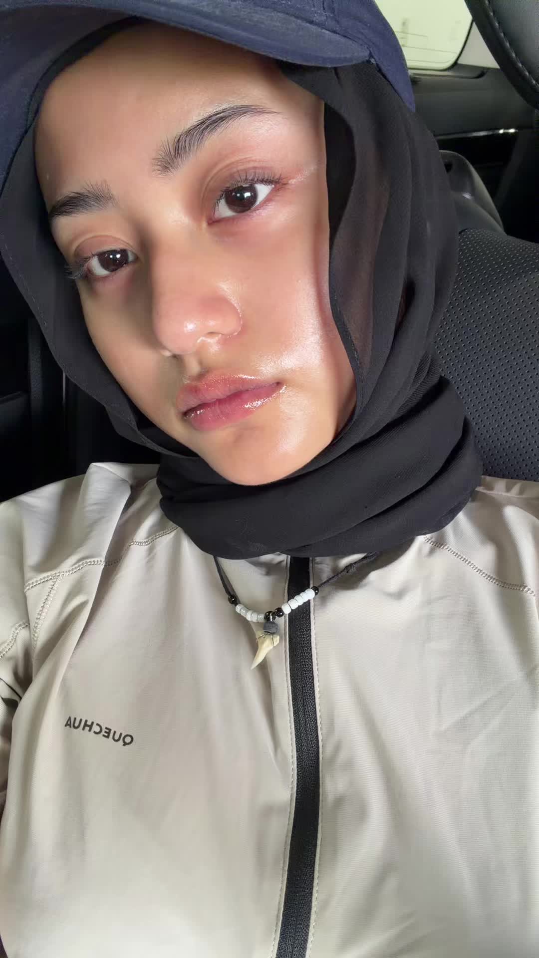 @amn1