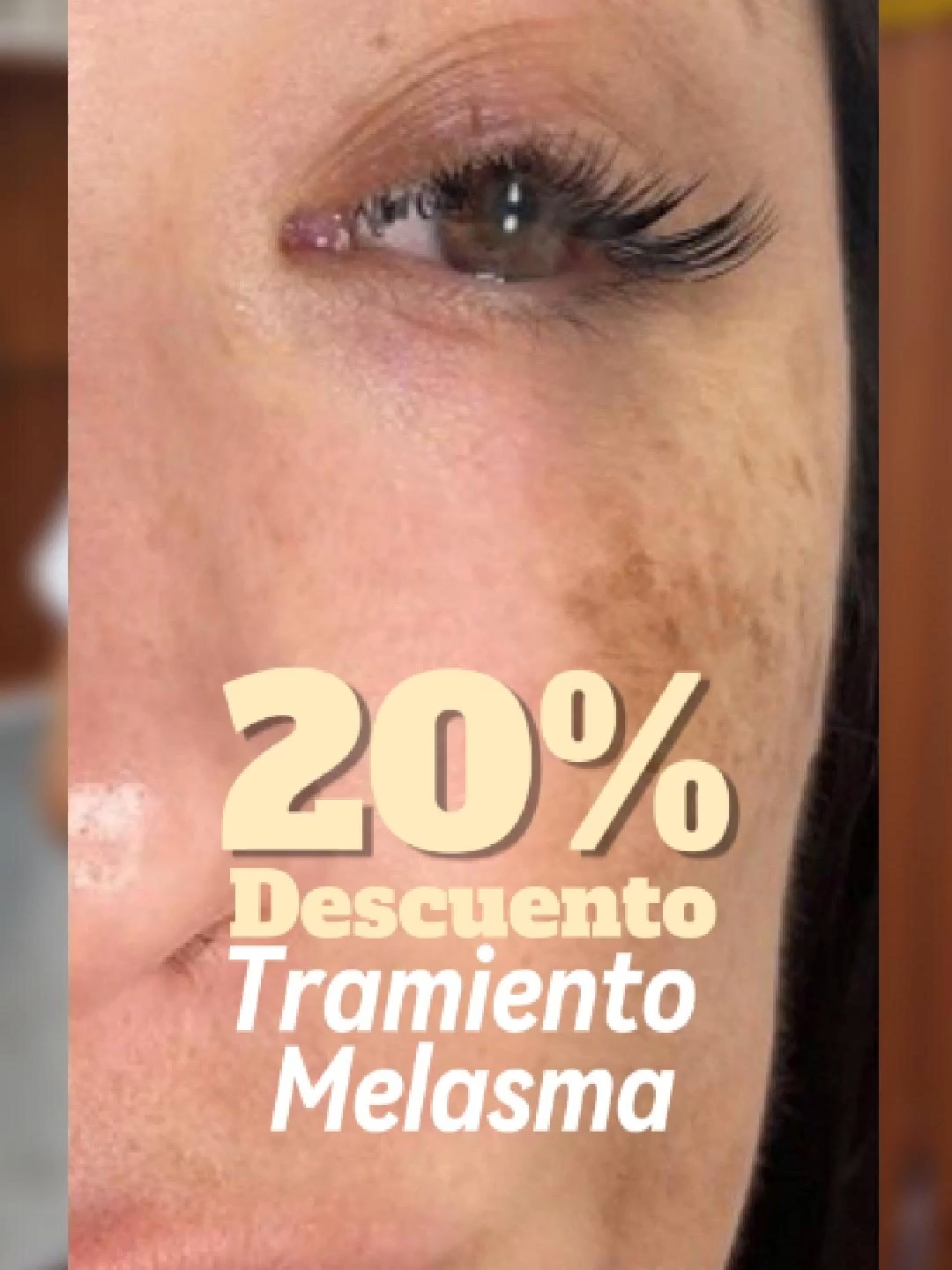 @RebellSpa