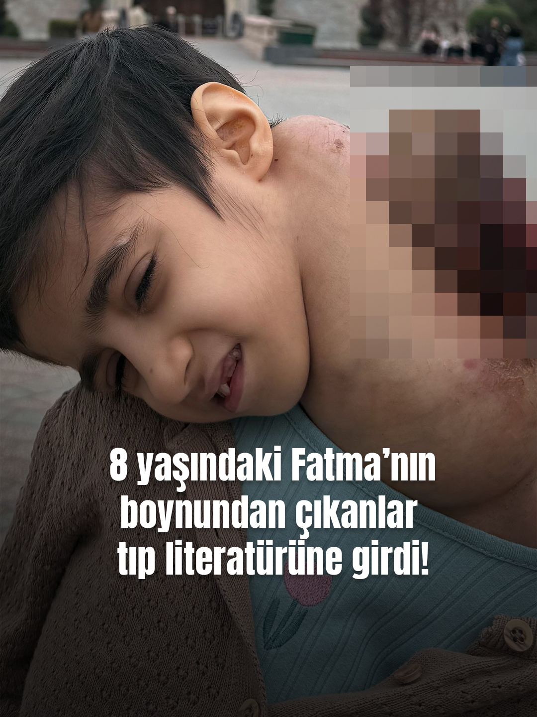 @Mynet