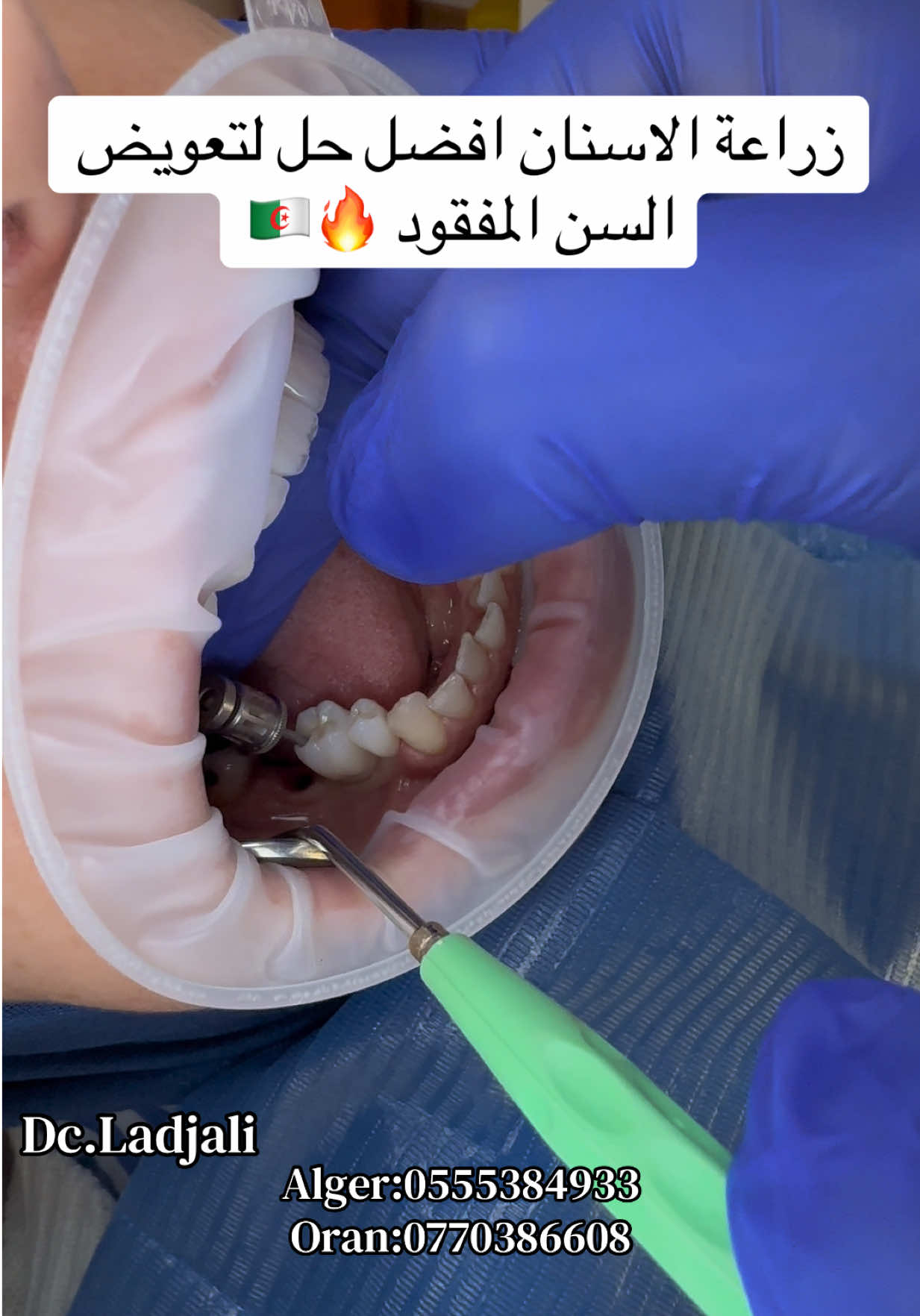@Dr.ladjali
