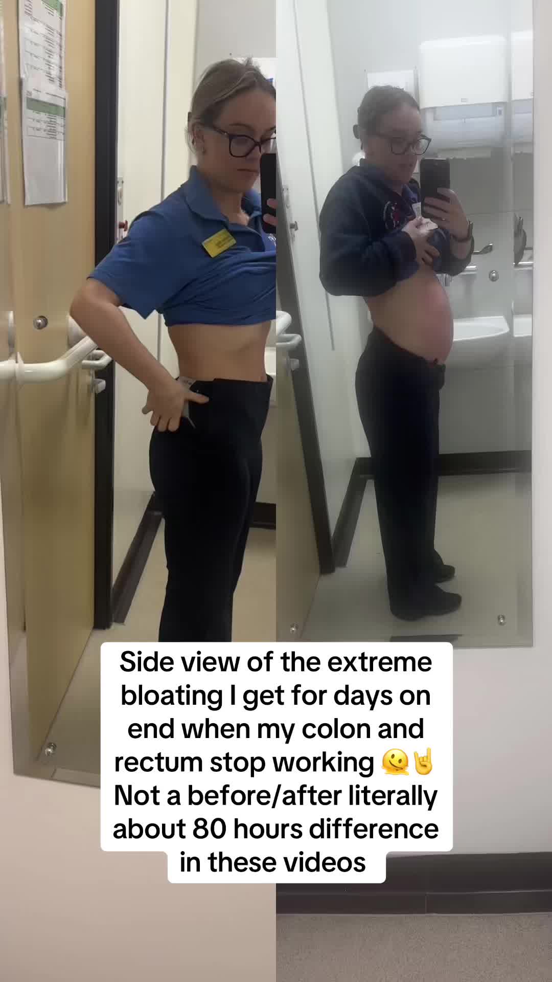 @Soph | IBD | POTS | EDS🦓🤍