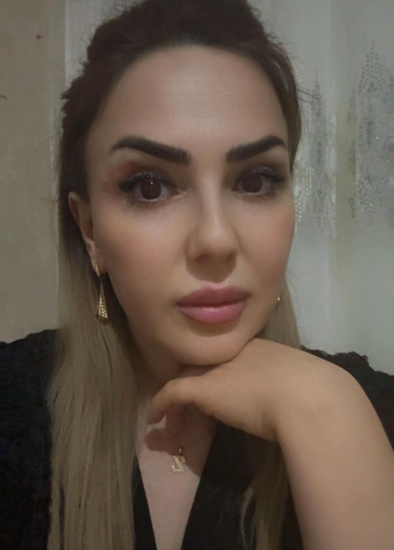 @Xankəndi.Şuşa.💉Kosmetoloq💉
