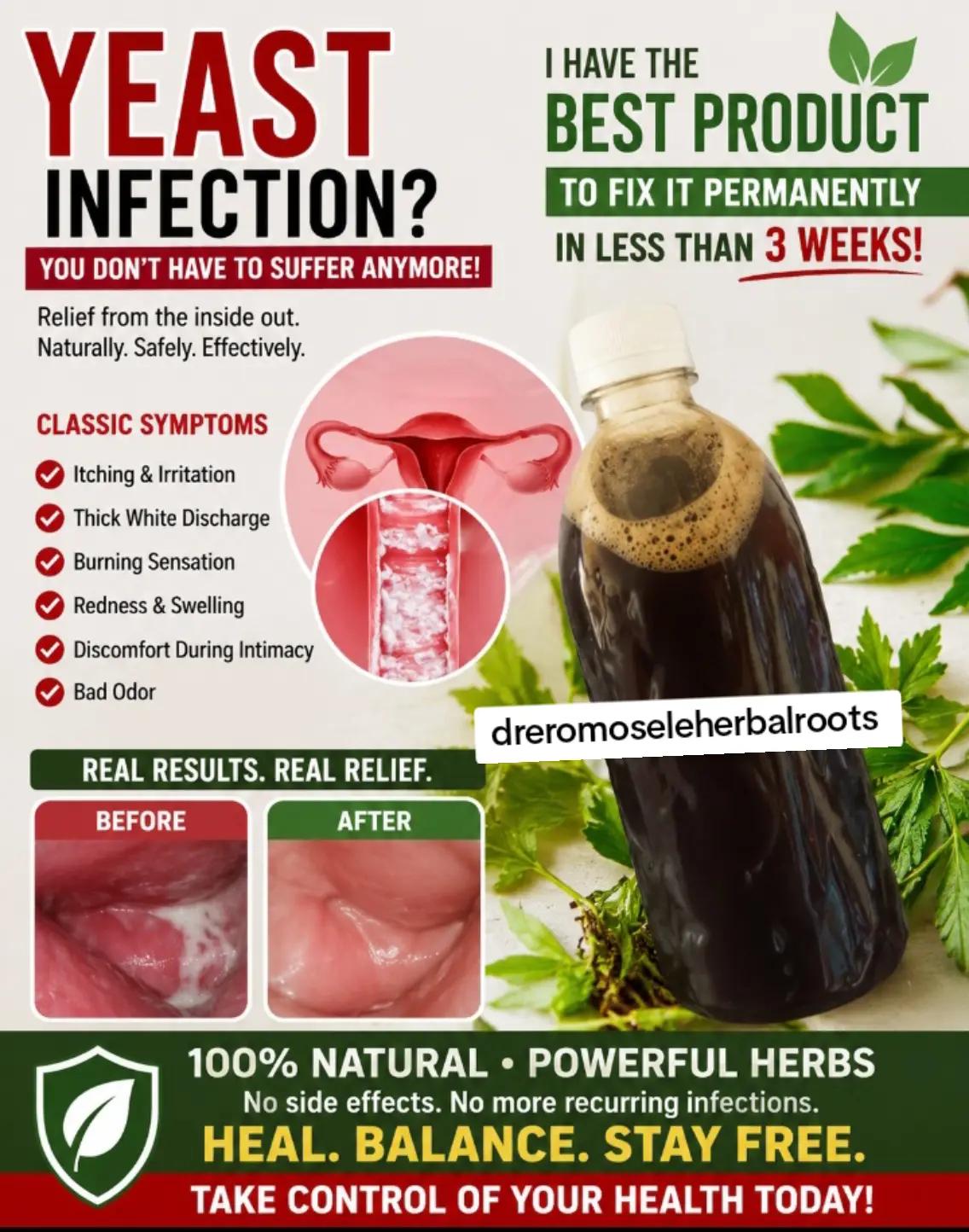 @DR EROMOSELE HERBALROOTS