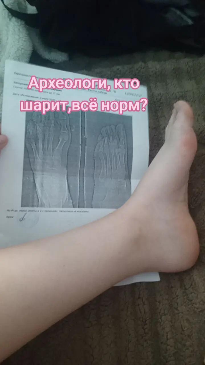 @FKS