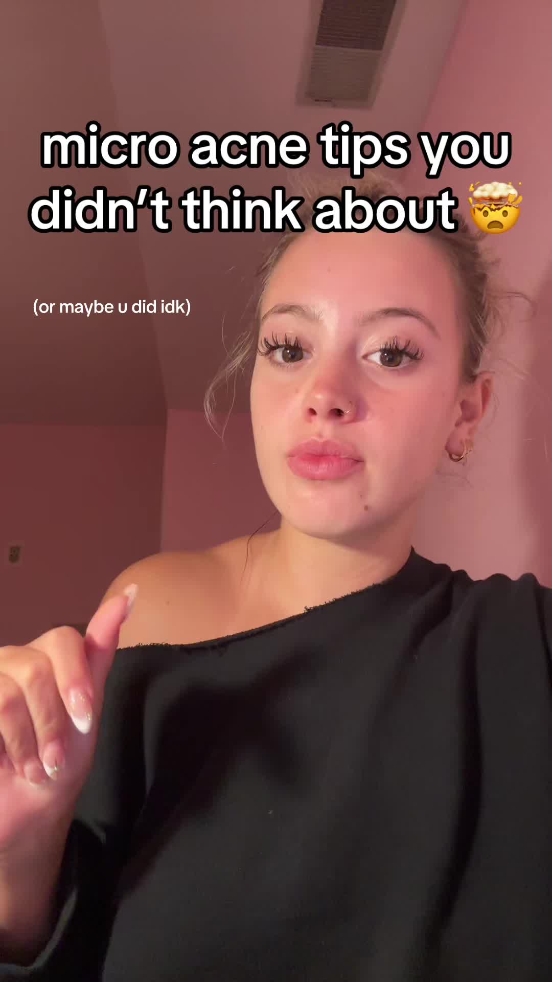 @cheeto🙈