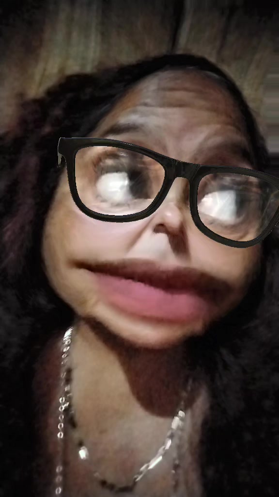 @Noe